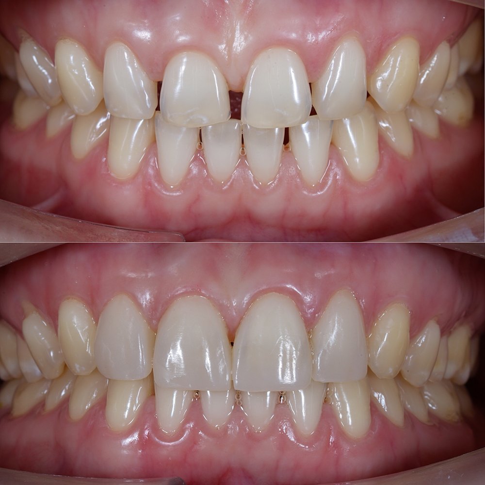 Cosmetic Dr. Zenonos – The Dental Clinic